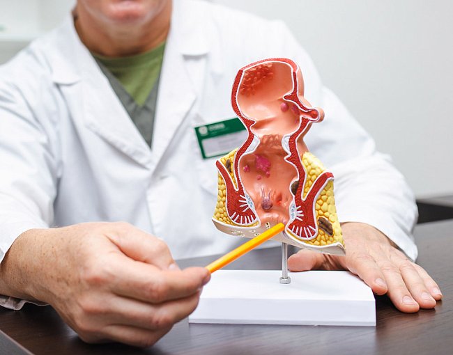 Колопроктолог