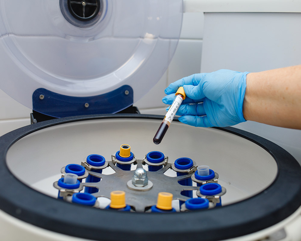 Лабораторная диагностика