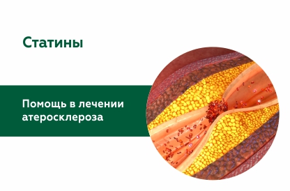 Статины и риск атеросклероза: как преодолеть страхи и сомнения?
