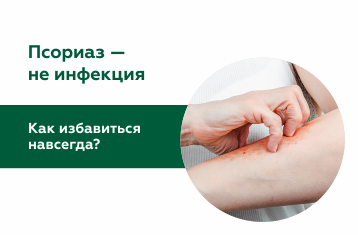 Псориаз: что это за болезнь, как лечить и предотвратить рецидивы