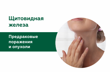 Предраковые поражения и опухоли щитовидной железы