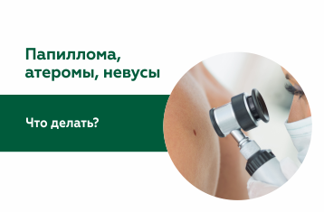 Папиллома, атеромы, невусы. Что делать?
