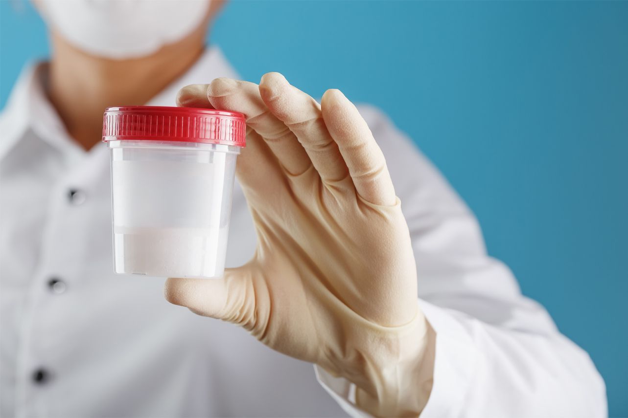 Подготовка к спермограмме